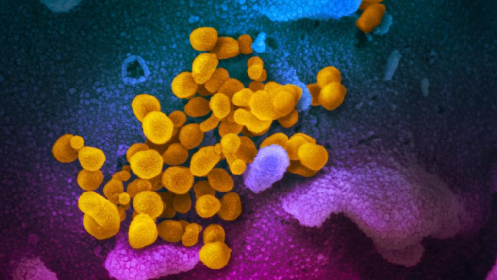 SARS-CoV-2 unter dem Elektronenmikroskop SARS-CoV-2 unter dem Elektronenmikroskop | Bildrechte: NIAID-RML (CC BY 2.0)