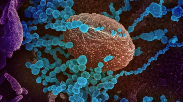 SARS-CoV-2 unter dem Elektronenmikroskop | Bildrechte: NIAID-RML (CC BY 2.0)