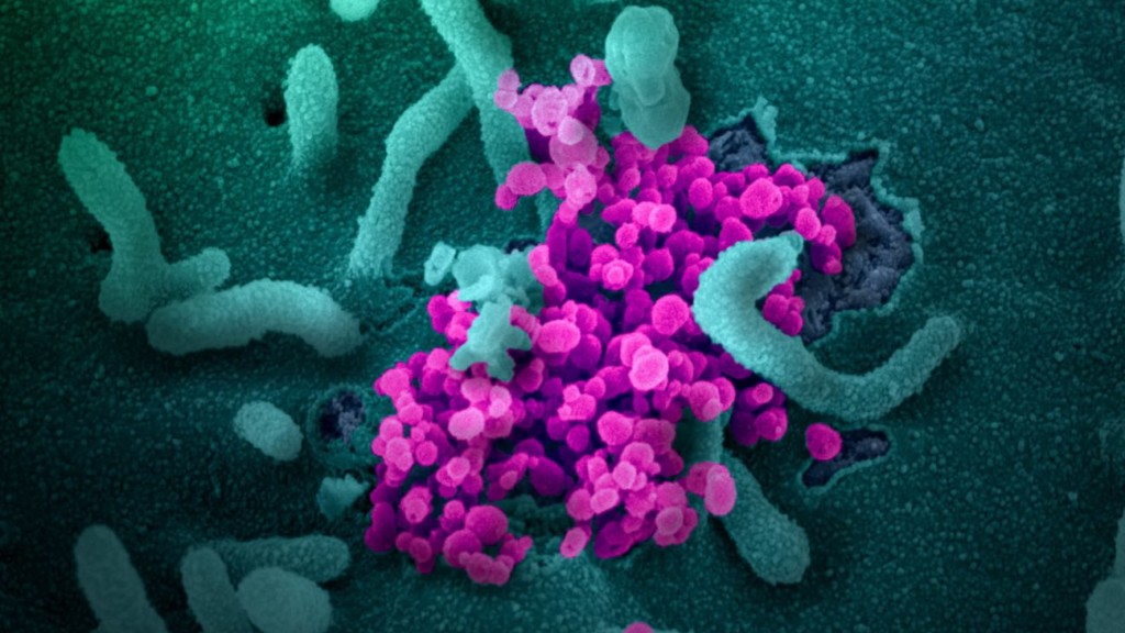 SARS-CoV-2 unter dem Elektronenmikroskop SARS-CoV-2 unter dem Elektronenmikroskop | Bildrechte: NIAID-RML (CC BY 2.0)
