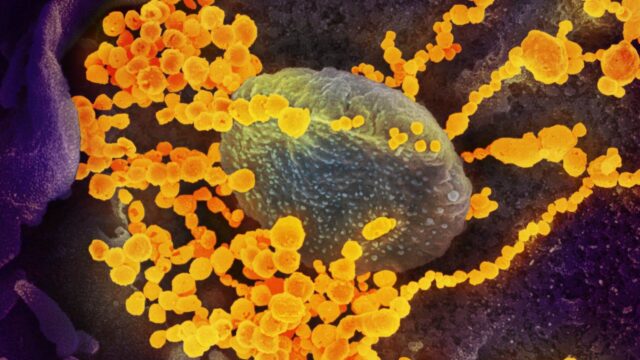 SARS-CoV-2 unter dem Elektronenmikroskop SARS-CoV-2 unter dem Elektronenmikroskop | Bildrechte: NIAID-RML (CC BY 2.0)